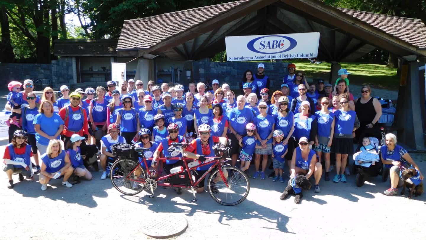 Image of Scleroderma Association of B.C. members with their bicycles at their 2018 Ride for Research.