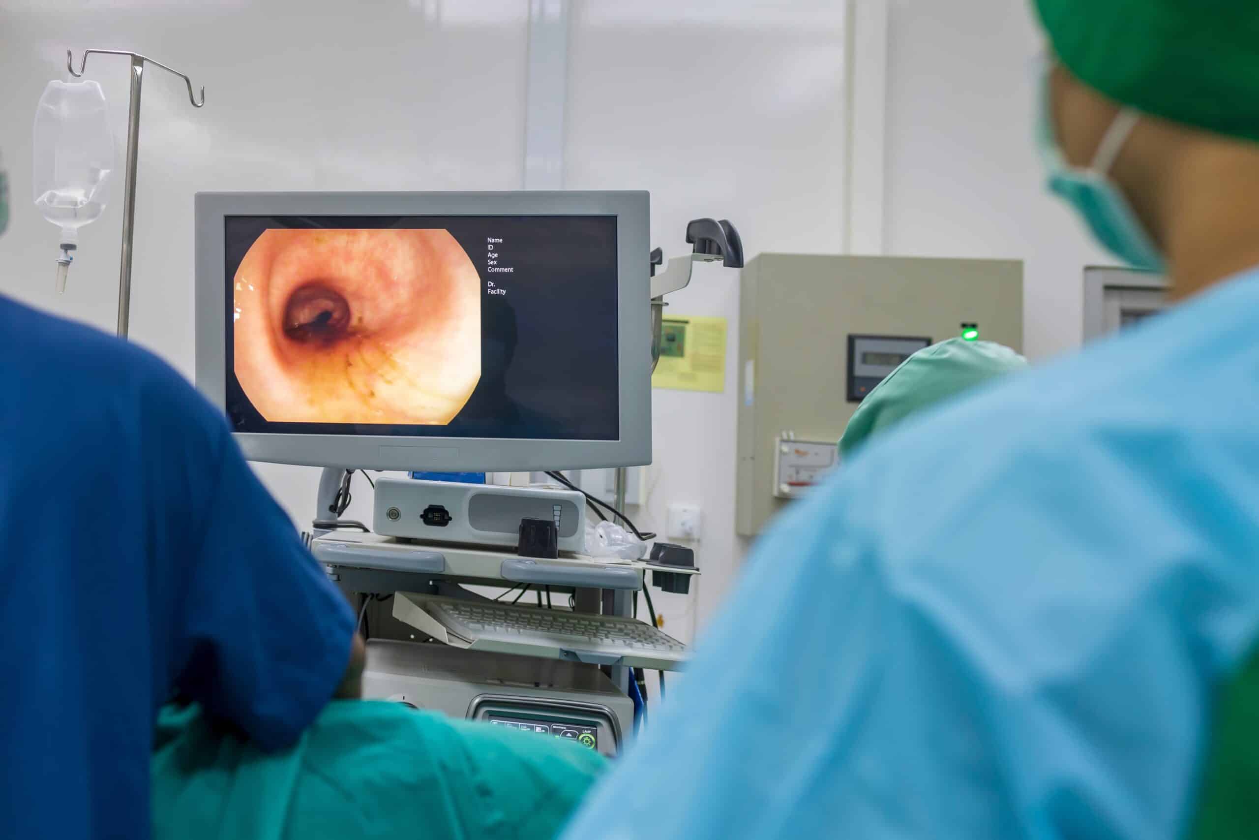 A doctor or surgeon in a light blue protective gown did a colonoscopy or gastroscopy inside operating theatre in the hospital.EGD technology for cancer screening. Blur green background and foreground.