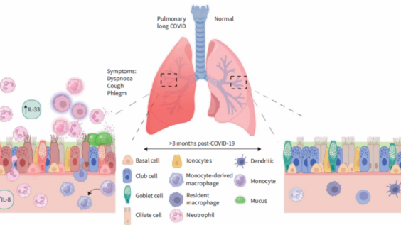 A figure of a proposed landscape of the small airways with pulmonary long COVID.