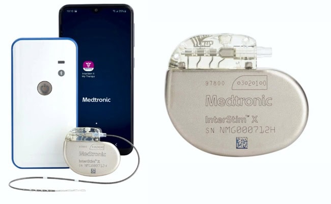 Photo of the device that helps with incontinence, and an image of the phone app that modulates it.