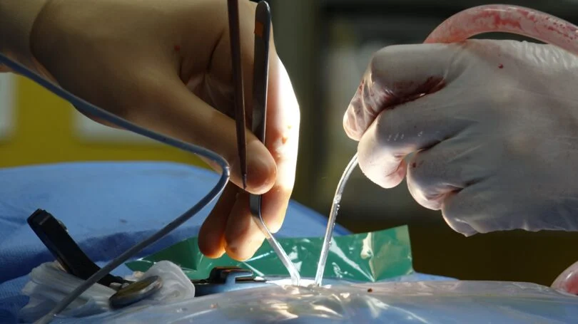 Close teamwork helped St. Paul's Hospital introduce a new endoscopic treatment option for patients with low-grade stomach tumours.